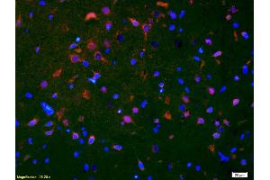Formalin-fixed and paraffin-embedded rat brain labeled with Anti-Smoothened/SMO Polyclonal Antibody, Unconjugated (ABIN680908) 1:200, overnight at 4°C, The secondary antibody was Goat Anti-Rabbit IgG, Cy3 conjugated used at 1:200 dilution for 40 minutes at 37°C. (SMO Antikörper  (AA 551-650))