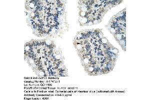 Rabbit Anti-GIPC2 Antibody  Paraffin Embedded Tissue: Human Intestine Cellular Data: Epithelial cells of intestinal villas Antibody Concentration: 4. (GIPC2 Antikörper  (N-Term))