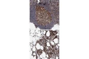 Immunohistochemical staining of human bone marrow with KIF4A polyclonal antibody  shows strong nuclear positivity in hematopoietic cells at 1:200-1:500 dilution.
