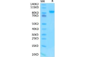 Human/Cynomolgus/Rhesus macaque ROR1 on Tris-Bis PAGE under reduced condition. (ROR1 Protein (AA 30-403) (Fc Tag))