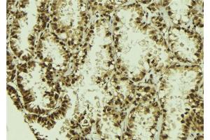 ABIN6273011 at 1/100 staining Human lung tissue by IHC-P.