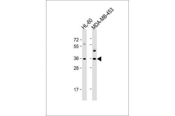 OR1J4 Antikörper  (C-Term)