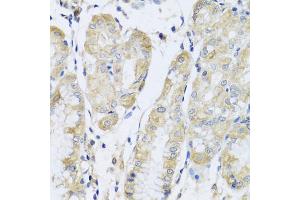 Immunohistochemistry of paraffin-embedded human stomach using FANCA antibody (ABIN5975159) at dilution of 1/100 (40x lens). (FANCA Antikörper)