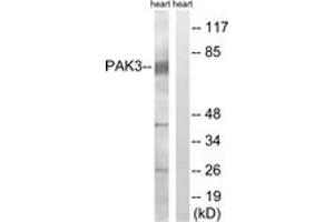 Western blot analysis of extracts from rat heart cells, using PAK3 (Ab-154) Antibody. (PAK3 Antikörper  (AA 121-170))