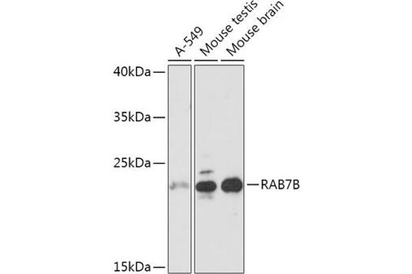 RAB7B anticorps  (AA 1-199)