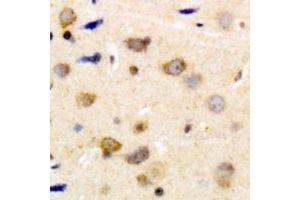 Immunohistochemical analysis of Caldesmon (pS789) staining in human brain formalin fixed paraffin embedded tissue section.