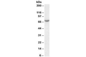 Western blot testing of human placenta lysate with Arylsulfatase C antibody at 0. (STS Antikörper)