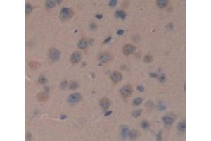 Figure. (NME1 Antikörper  (AA 6-147))