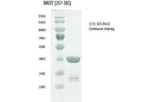 Recombinant BRDT (257-382), GST-tag protein gel.