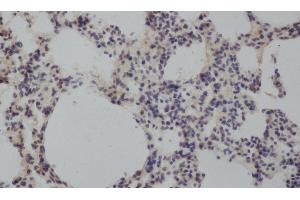 Immunohistochemistry of paraffin-embedded Rat lung using MMP8 Polyclonal Antibody at dilution of 1:50 (MMP8 Antikörper)