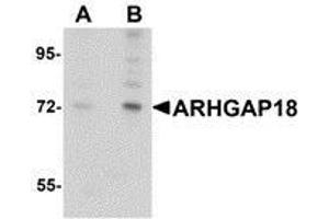 Western blot analysis of ARHGAP18 in 3T3 cell lysate with AP30079PU-N ARHGAP18 antibody at (A) 1 and (B) 2 μg/ml. (ARHGAP18 Antikörper  (C-Term))
