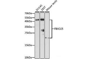 Western blot analysis of extracts of various cell lines using FBXO25 Polyclonal Antibody at dilution of 1:1000. (FBXO25 Antikörper)