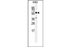 Image no. 1 for anti-Cell Division Cycle 25 Homolog C (S. Pombe) (CDC25C) (C-Term) antibody (ABIN360223) (CDC25C Antikörper  (C-Term))
