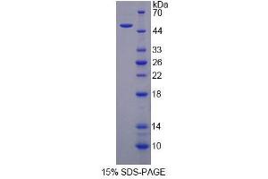 SDS-PAGE (SDS) image for Perilipin 1 (PLIN1) (AA 1-210) protein (His tag,GST tag) (ABIN6237807) (PLIN1 Protein (AA 1-210) (His tag,GST tag))