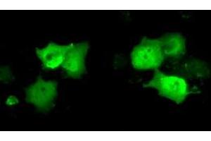Anti-C21orf59 mouse monoclonal antibody (ABIN2452867) immunofluorescent staining of COS7 cells transiently transfected by pCMV6-ENTRY C21orf59 (RC200169). (C21orf59 Antikörper)