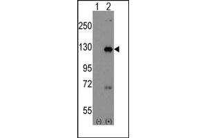 Image no. 2 for anti-Dishevelled Associated Activator of Morphogenesis 1 (DAAM1) (C-Term), (N-Term) antibody (ABIN357856)
