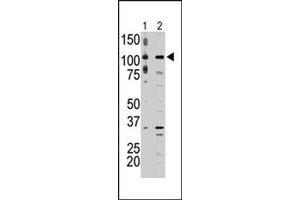 The MAP3K9 polyclonal antibody  is used in Western blot to detect MAP3K9 in A-375 cell lysate (lane 1) and rat testis tissue lysate (lane 2) .