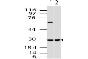 Image no. 1 for anti-CUE Domain Containing 2 (CUEDC2) (AA 100-280) antibody (ABIN5027122) (CUEDC2 Antikörper  (AA 100-280))