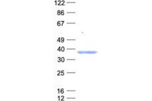 Validation with Western Blot (SLUG Protein (His tag))