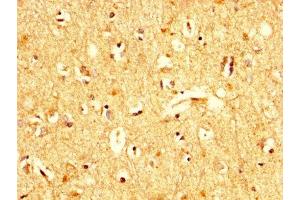 IHC image of ABIN7174409 diluted at 1:200 and staining in paraffin-embedded human brain tissue performed on a Leica BondTM system. (UBA52 Antikörper  (AA 1-128))