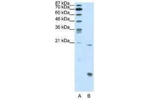 WB Suggested Anti-RUNX1  Antibody Titration: 0. (RUNX1 Antikörper  (N-Term))