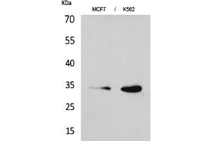 Western Blot analysis of MCF7 (1), K562 (2). (CDK4 Antikörper  (N-Term))