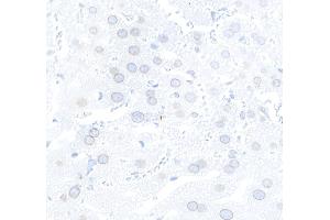 Immunohistochemistry (IHC) image for anti-Nucleoprotein TPR (TPR) (C-Term) antibody (ABIN7448922) (TPR Antikörper  (C-Term))