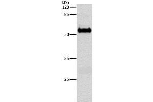 Western Blot analysis of Mouse brain tissue using SLC1A6 Polyclonal Antibody at dilution of 1:600 (SLC1A6 Antikörper)