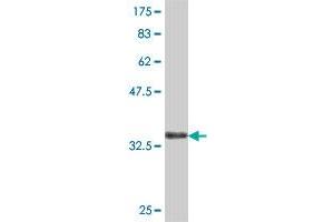 Western Blot detection against Immunogen (37 KDa) . (VPS41 Antikörper  (AA 755-853))