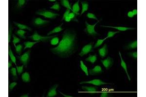 Image no. 3 for anti-PDZ Binding Kinase (PBK) (AA 1-110) antibody (ABIN599272) (PBK Antikörper  (AA 1-110))