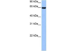 Collagen Type IV alpha 3 antibody used at 1 ug/ml to detect target protein. (COL4a3 Antikörper)