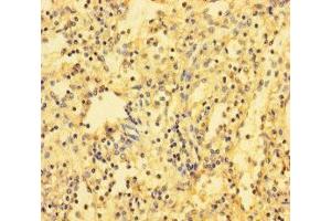 Immunohistochemistry of paraffin-embedded human spleen tissue using ABIN7171517 at dilution of 1:100 (ABI3BP Antikörper  (AA 601-900))