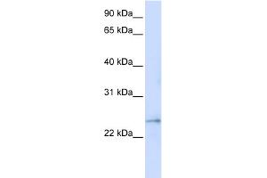 WB Suggested Anti-FAM156A Antibody Titration:  0. (FAM156A Antikörper  (Middle Region))
