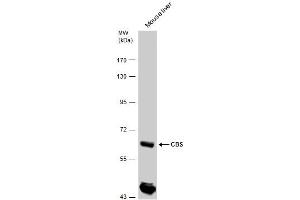 WB Image CBS antibody detects CBS protein by western blot analysis. (CBS Antikörper)