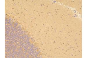 IHC analysis of PPA1 using anti-PPA1 antibody (ABIN6719527).