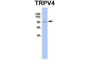 Host:  Rabbit  Target Name:  TRPV4  Sample Type:  HT1080  Antibody Dilution:  1. (TRPV4 Antikörper  (Middle Region))