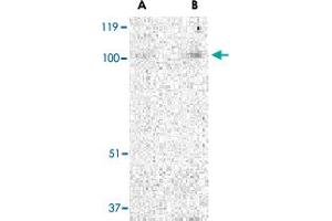 Western blot analysis of TRPC3 in mouse heart tissue lysate with TRPC3 polyclonal antibody  at (A) 1 and (B) 2 ug/mL . (TRPC3 Antikörper  (N-Term))