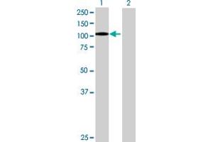 Western Blot analysis of ITGB2 expression in transfected 293T cell line by ITGB2 MaxPab polyclonal antibody. (Integrin beta 2 Antikörper  (AA 1-769))