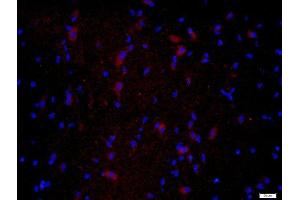 Immunofluorescence (Paraffin-embedded Sections) (IF (p)) image for anti-Complexin 1 (CPLX1) (AA 31-100) antibody (ABIN1385745)
