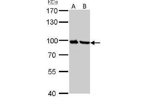 Western Blotting (WB) image for anti-Plasminogen (PLG) antibody (ABIN2855505)