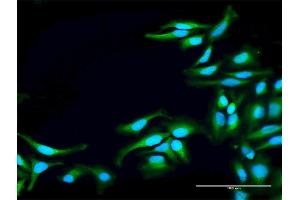 Immunofluorescence of purified MaxPab antibody to TNK2 on HeLa cell. (TNK2 Antikörper  (AA 1-352))