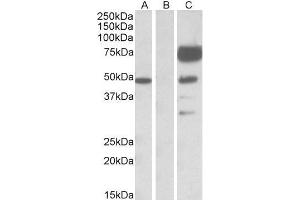 HEK293 lysate (10ug protein in RIPA buffer) overexpressing Human ANGPT1 with DYKDDDDK tag probed with ABIN768552(1ug/ml) in Lane A and probed with anti- DYKDDDDK Tag (1/1000) in lane C. (Angiopoietin 1 Antikörper  (Internal Region))