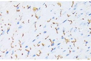 Immunohistochemistry of paraffin-embedded Mouse heart using Phospho-GJA1(S368) Polyclonal Antibody at dilution of 1:200 (40x lens). (Connexin 43/GJA1 Antikörper  (pSer368))