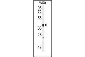 Western blot analysis of OR2T8 Antibody (C-term) in WiDr cell line lysates (35ug/lane).