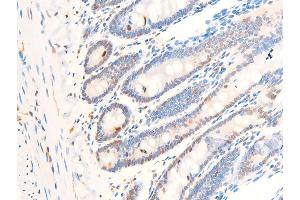 Immunohistochemistry (IHC) image for anti-Myc Proto-Oncogene protein (MYC) (pThr58) antibody (ABIN6256584)