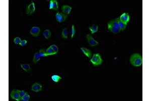 Immunofluorescent analysis of MCF-7 cells using ABIN7173179 at dilution of 1:100 and Alexa Fluor 488-congugated AffiniPure Goat Anti-Rabbit IgG(H+L) (TMEM255B Antikörper  (AA 221-356))