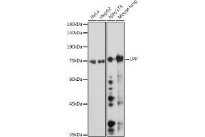 Western blot analysis of extracts of various cell lines, using LPP antibody (ABIN7268284) at 1:1000 dilution. (LPP Antikörper)