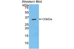 Western Blotting (WB) image for anti-Integrin beta 1 (ITGB1) (AA 454-714) antibody (ABIN1859501) (ITGB1 Antikörper  (AA 454-714))