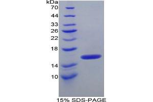 SDS-PAGE analysis of Human ITIH4 Protein. (ITIH4 Protein)
