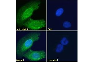 ABIN5539846 Immunofluorescence analysis of paraformaldehyde fixed U2OS cells, permeabilized with 0.
